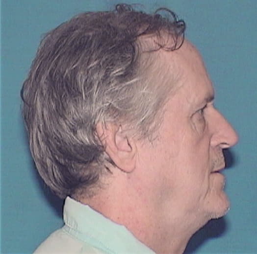 DOUGLAS, JOHN, McLean County  IL