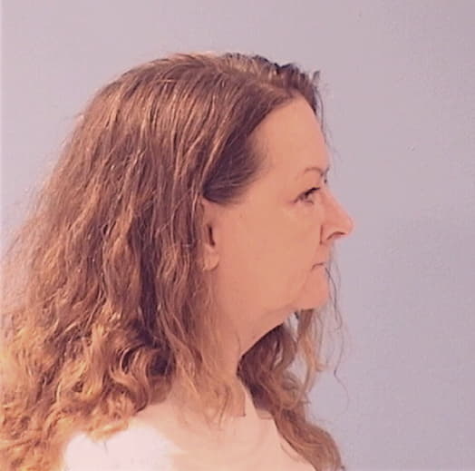 MILBRODT, KELLIE J., Macon County  IL