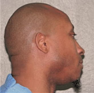 THRELKELD, MICHAEL, Cook County  IL