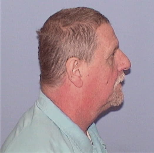 REINHARDT, MAX G., Fulton County  IL