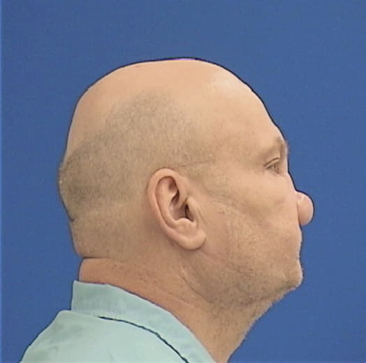MILES, THOMAS A., Coles County  IL