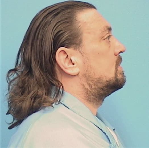 PERKINSON, LANCE A., Madison County  IL