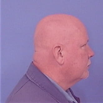 SKALISIUS, BYRON D., Madison County  IL