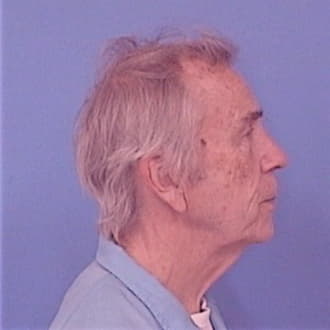 HILDENSTEIN, ROBERT J. SR, Madison County  IL
