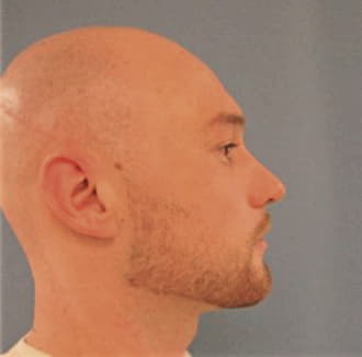 HOEGNER, ALEXANDER, DuPage County  IL