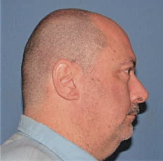BOSS, RANDALL, Cook County  IL