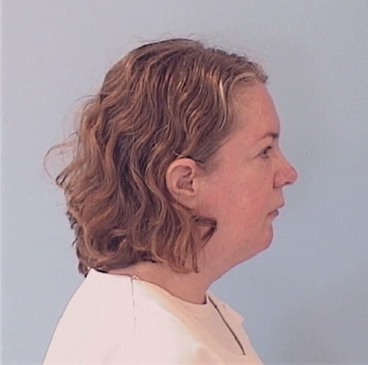 LEACH-PETERSON, NORA, Kane County  IL