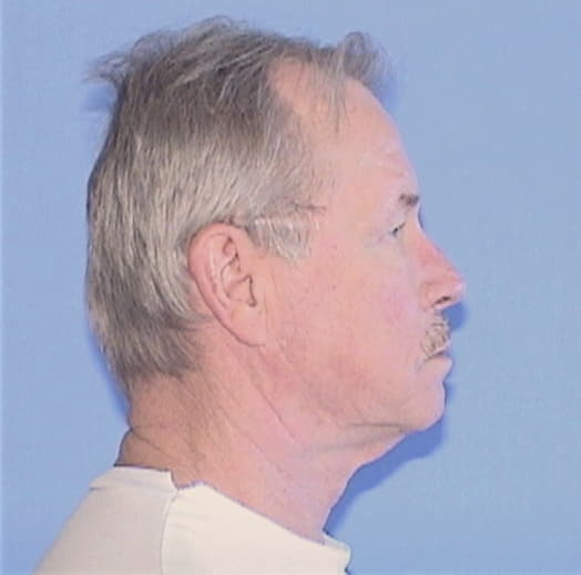 BEELER, LARRY K., McLean County  IL