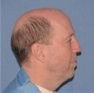 HENSHALL, WALLACE, McHenry County  IL