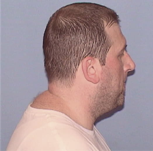 CHAMPLIN, WILLIAM E., Madison County  IL