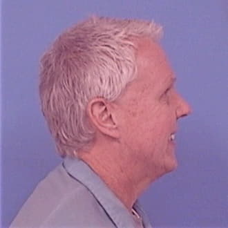 HERMAN, NICHOLAS L., Lake County  IL