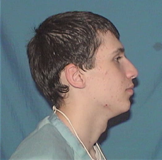 FOX, DOMENICK E., Madison County  IL