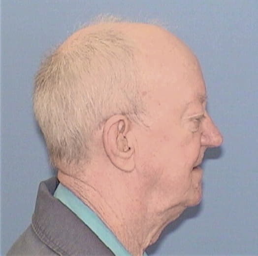 FELKER, JAMES E., White County  IL