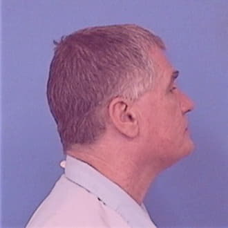 SEXTON, GERALD I., Dupage County  IL