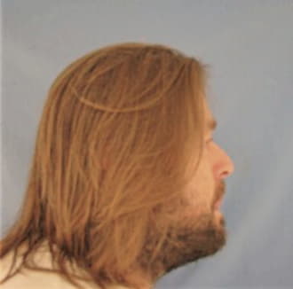 RITCHESON, ROY D., White County  IL
