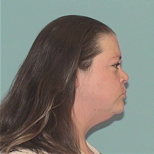 ONTIS-TURNBAUGH, MELISSA, Morgan County  IL