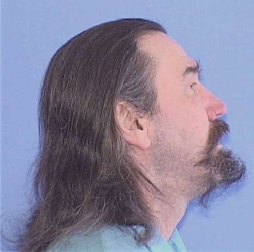 HOPPE, CHARLES R., Madison County  IL