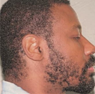 DAVIS, MEYUNTOE L., Sangamon County  IL