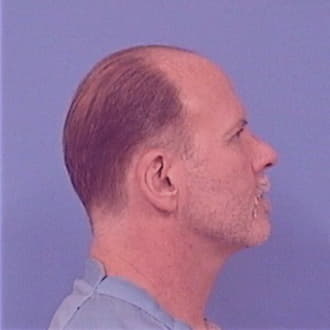 HILL, JOSEPH R., McHenry County  IL