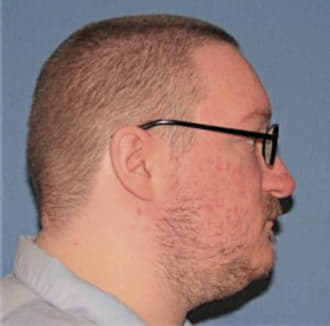 WOJDYLA, JOSEPH A., Lake County  IL
