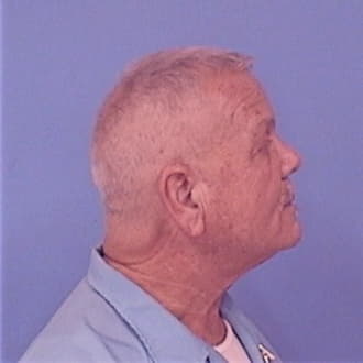 MASON, CARL D. JR, DeWitt County  IL