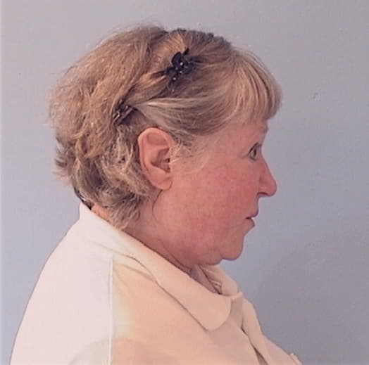 BAUMGARTNER, SANDRA, Kane County  IL