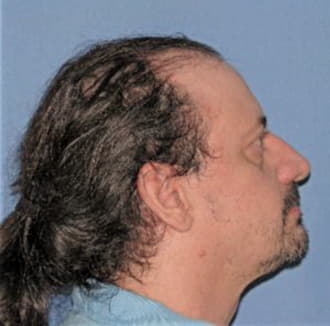 VARNAUSKAS, STEVEN J., Henry County  IL