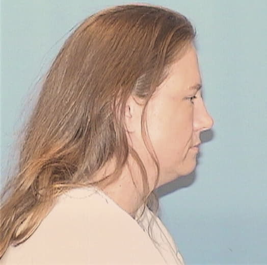 DUNN, STARLETT R., White County  IL