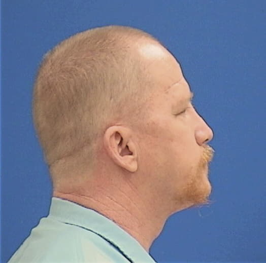 STARRETT, ANTHONY A., Jackson County  IL