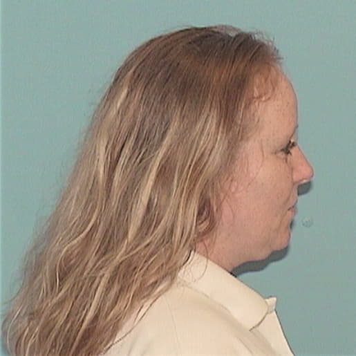 REKART, KARI A., Montgomery County  IL