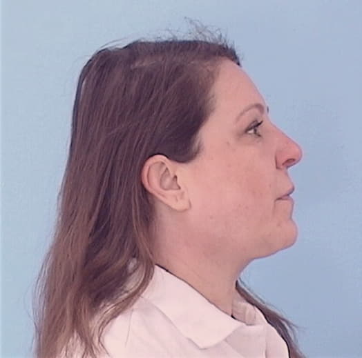 PLACKOWSKA, ELZBIETA M., DuPage County  IL