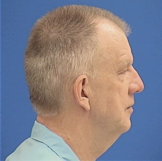 HOBSON, MICHAEL G., McLean County  IL
