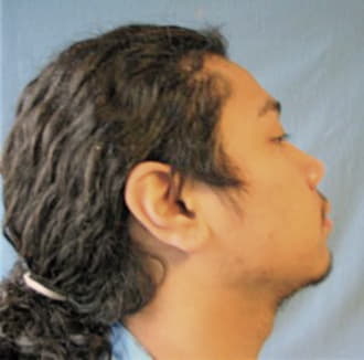 ESTEVESBARRERA, EMILIO M., Winnebago County  IL