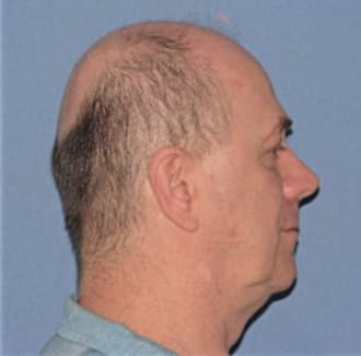 VESELY, JEFFREY, McHenry County  IL