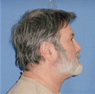 BAUMGARTNER, PETER, Cook County  IL