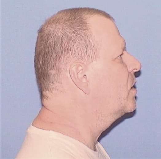 ANDERSON, RONALD, Kane County  IL