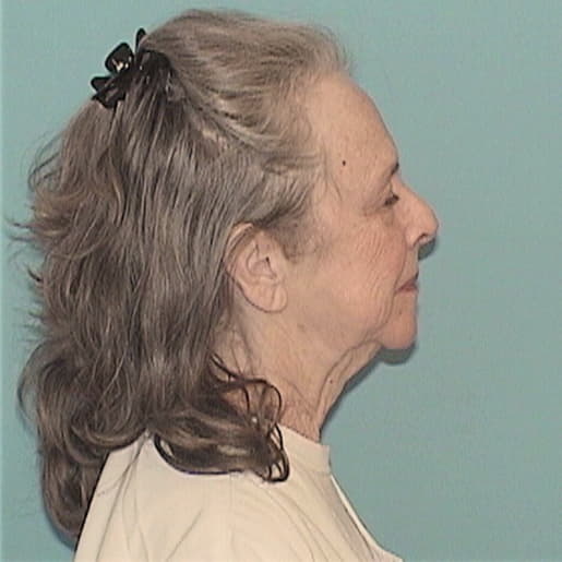 FUCHS, CYNTHIA L., Sangamon County  IL