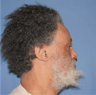 TURNER, LOUIS, Cook County  IL