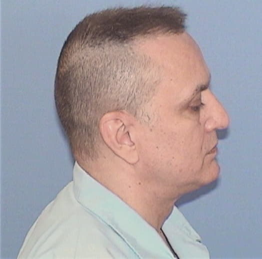 ARTIS, LAWRENCE S., McLean County  IL