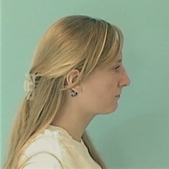 SCHOLLMEIER, CHELSEA L., Madison County  IL