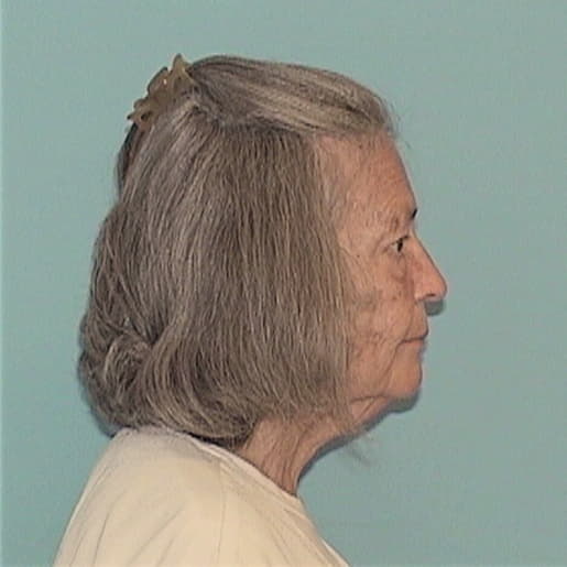 LISCHKE, PATRICIA H., DuPage County  IL