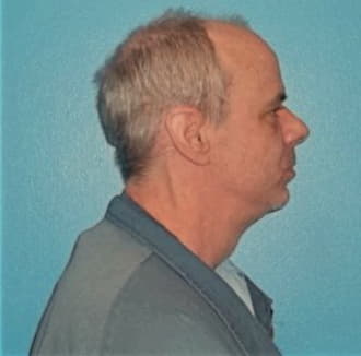 MEMLER, DOUGLAS D., Dupage County  IL