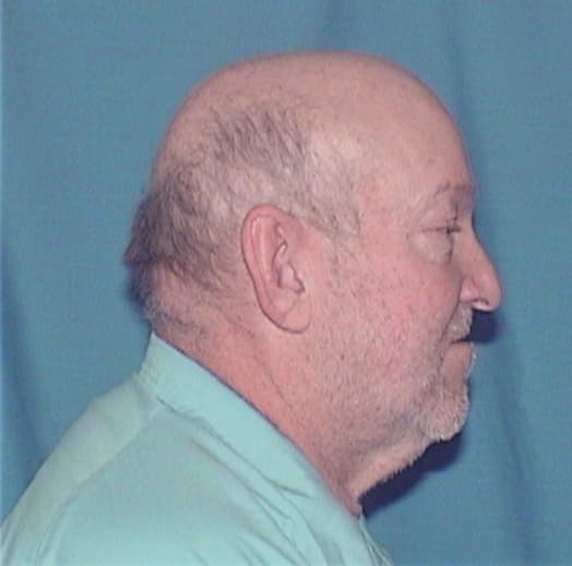 REINBOLD, WILLIAM C., Knox County  IL