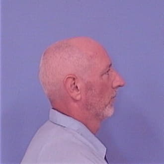 LAWSON, KENNETH M., Madison County  IL