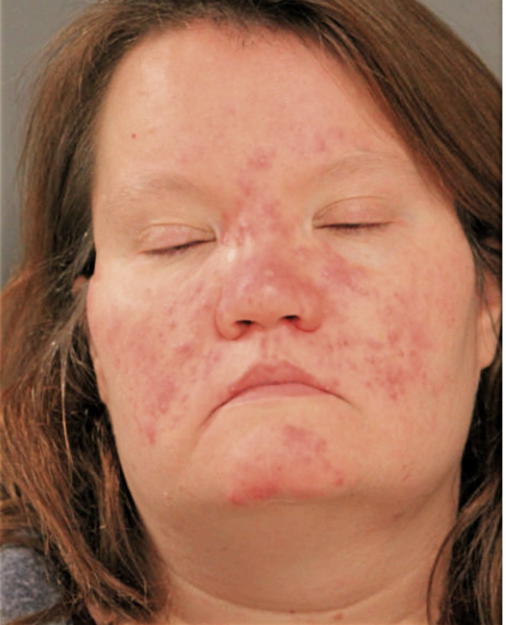 SUSAN BARKER, Cook County, Illinois
